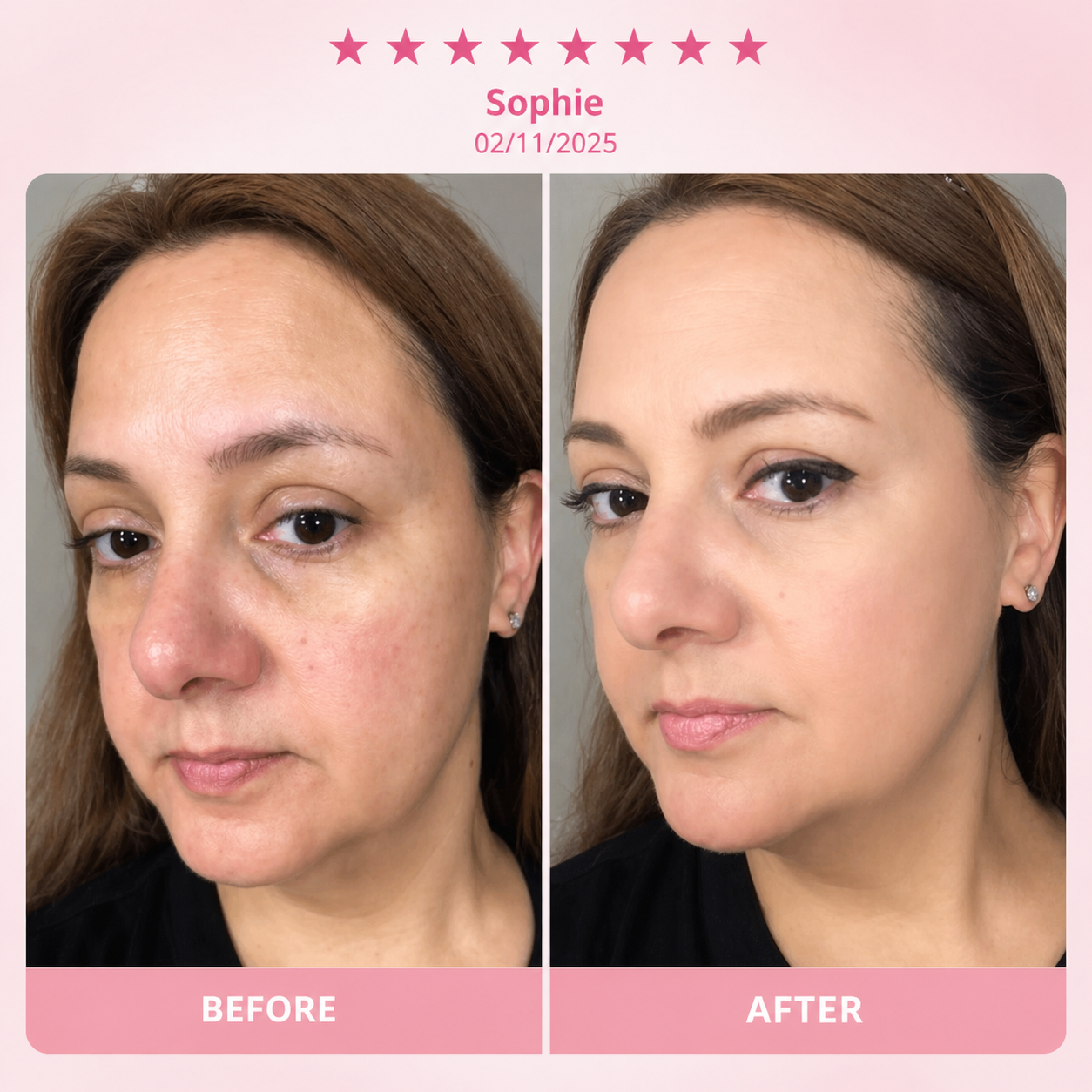 Hot Selling Collagen Moisturizing Cream